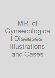 Cover MRI of Gynaecological Diseases: Illustrations and Cases