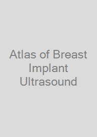Cover Atlas of Breast Implant Ultrasound