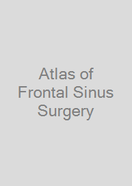 Atlas of Frontal Sinus Surgery