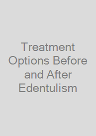 Treatment Options Before and After Edentulism