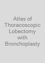 Atlas of Thoracoscopic Lobectomy with Bronchoplasty