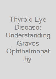 Cover Thyroid Eye Disease: Understanding Graves Ophthalmopathy