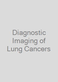 Diagnostic Imaging of Lung Cancers