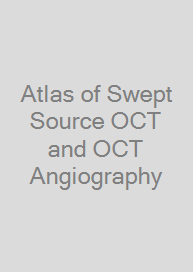 Cover Atlas of Swept Source OCT and OCT Angiography