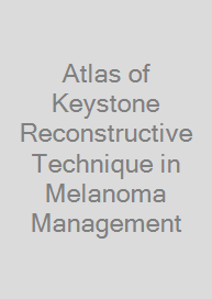 Atlas of Keystone Reconstructive Technique in Melanoma Management
