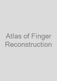 Cover Atlas of Finger Reconstruction