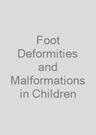 Foot Deformities and Malformations in Children