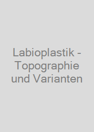 Labioplastik - Topographie und Varianten