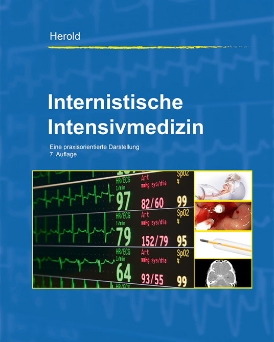Internistische Intensivmedizin