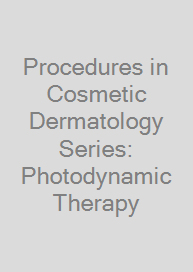 Cover Procedures in Cosmetic Dermatology Series: Photodynamic Therapy