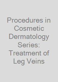 Cover Procedures in Cosmetic Dermatology Series: Treatment of Leg Veins